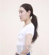 九院余力隆胸好保守是真的吗?有真实案例吗? width=