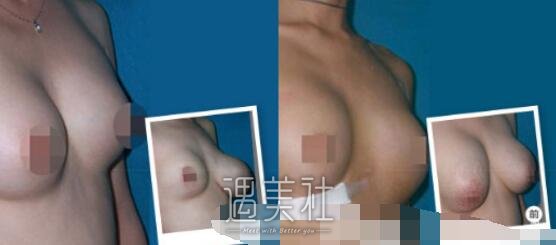 广州,华美,曙光