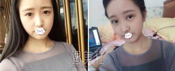 广州,华美,曙光