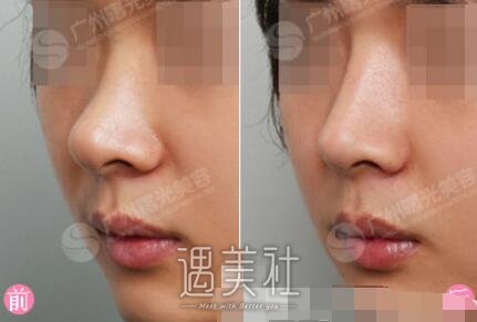 广州,华美,曙光