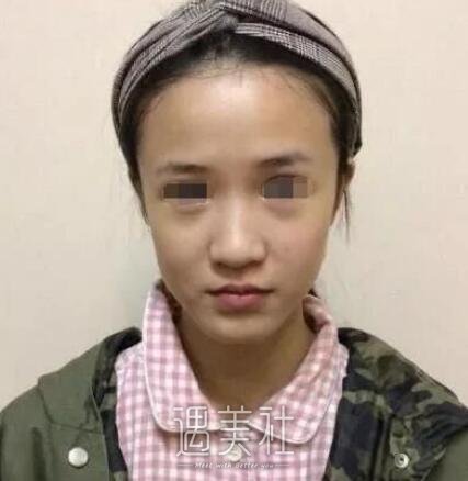 苏北整形美容,施泽宏