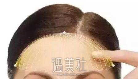 额头缩小