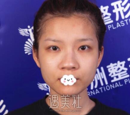 五洲,刘骏,双眼皮