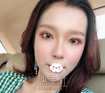 五洲,刘骏,双眼皮