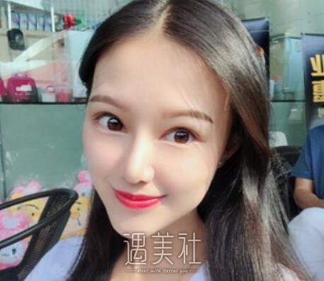 成都,米兰柏羽,隆鼻