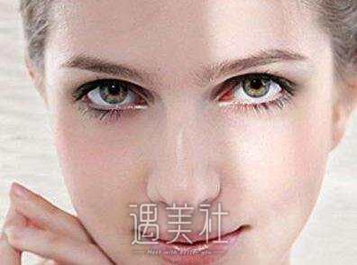 义乌张小红双眼皮价格是多少?比市场价贵吗?