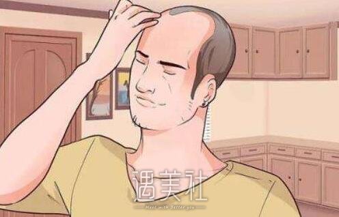 南京发际线移植多少钱?为什么别人做下来都是一万多?