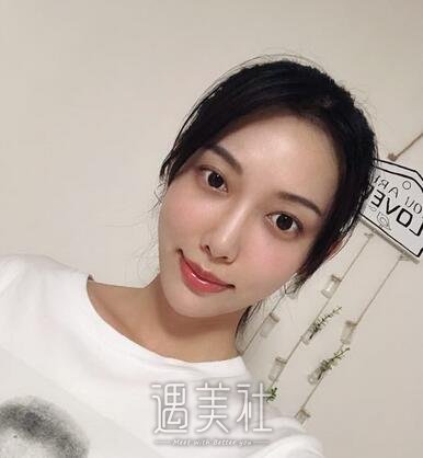 鲁树荣,脂肪填充