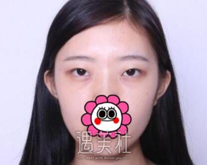 魏楠,双眼皮