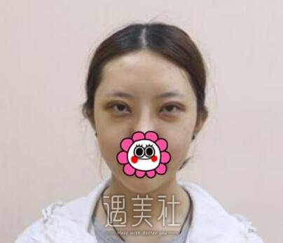 魏楠,双眼皮