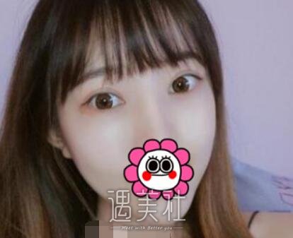 魏楠,双眼皮