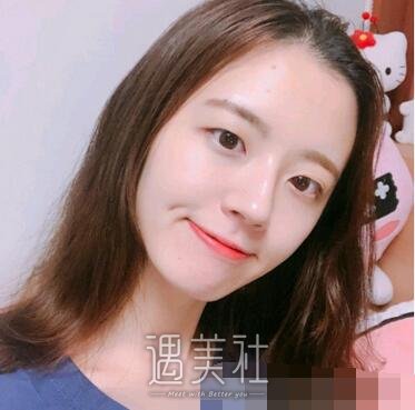 广州,徐翔,双眼皮