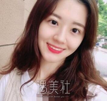 广州,徐翔,双眼皮