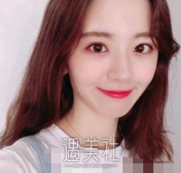 广州,徐翔,双眼皮