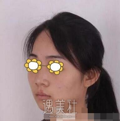 长沙,南湖,隆鼻