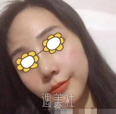 长沙,南湖,隆鼻