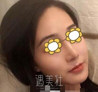 长沙,南湖,隆鼻