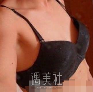 万连壮,隆胸