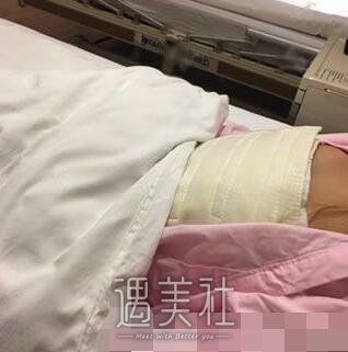 万连壮,隆胸
