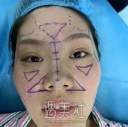 上海九院崔海燕做鼻子怎么样?有案例吗? width=