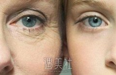 芜湖激光去鱼尾纹果怎么样，有哪些优点? width=