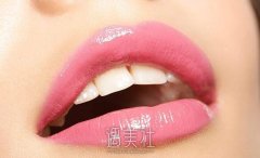 北京大学深圳医院牙齿矫正贵吗?影响因素有哪些? width=