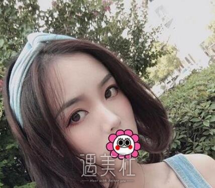 王琪影,双眼皮