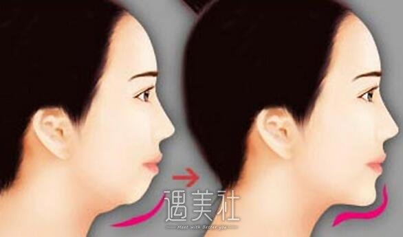 上海,改脸型