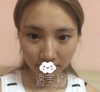 淄博一美整形美容医院祛斑怎么样？有真实案例吗？ width=