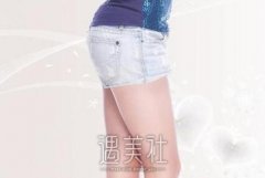 大腿吸脂果好不好，一次就可以做好吗？ width=