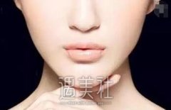 上海九院改脸型多少钱？会不会收费有点贵喃？ width=