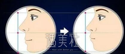 厦门,成年牙齿矫正