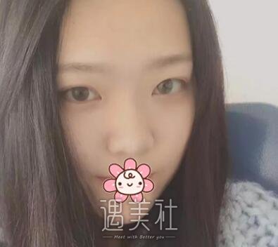 成都,奕后,刘俊,隆鼻