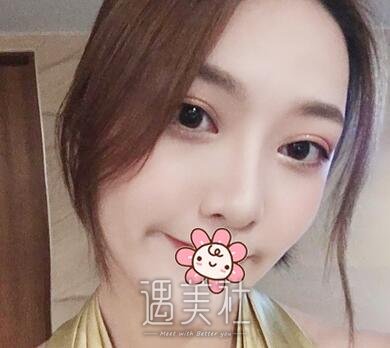 成都,奕后,刘俊,隆鼻
