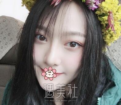成都,奕后,刘俊,隆鼻