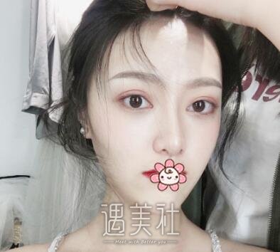 成都,奕后,刘俊,隆鼻