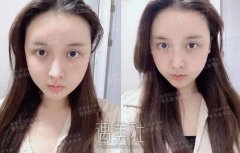 首尔丽格整形医院怎么样？颌面手术实力曝光 width=