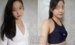 杭州维多利亚许凤芝案例曝光~ width=