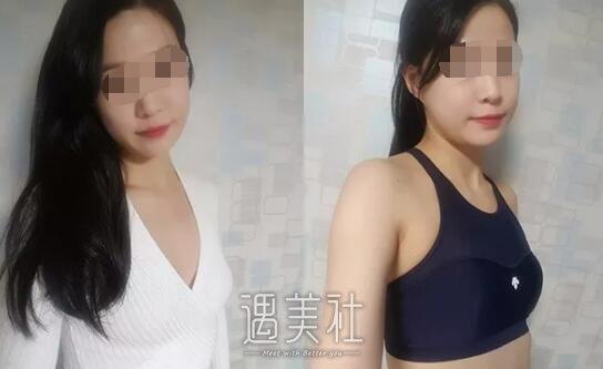 杭州维多利亚许凤芝案例曝光：技术果然******~