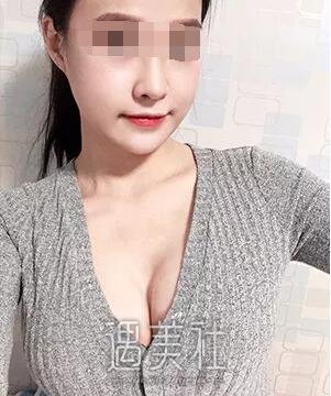 杭州维多利亚许凤芝案例曝光：技术果然******~