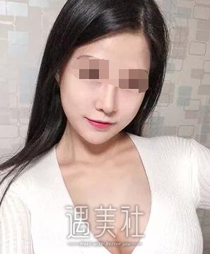 杭州维多利亚许凤芝案例曝光：技术果然******~