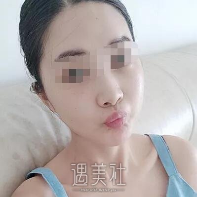 南京鼓楼医院整形科怎么样?有颧骨内推相关案例吗?