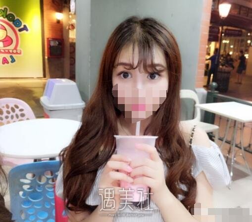 成都西蝉美容医院双眼皮怎么样?我也想逆天改命!