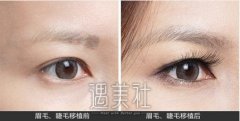 重庆种睫毛要多少钱?应该不会很贵吧? width=