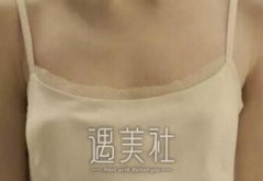 沈干手术案例有木有？听说沈干医生很不错哦~ width=