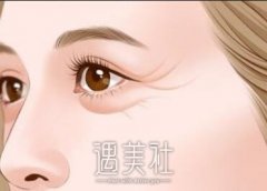 南昌激光祛皱多少钱，影响价格的因素? width=