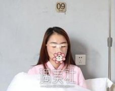 薛旦割双眼皮案例：薛医生技术果然值得信赖！ width=