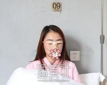 薛旦,割双眼皮