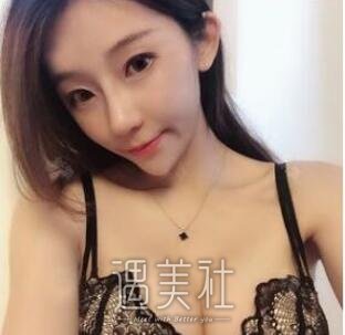 广州军美,王世虎,隆胸