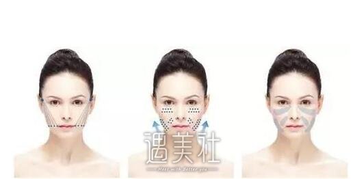 微整除皱要戴头套吗?网路上是这样说的~